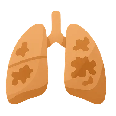 Idiopathic pulmonary fibrosis