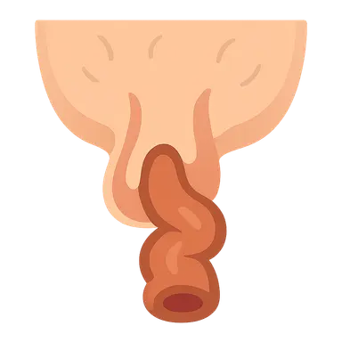 Rectal Prolapse