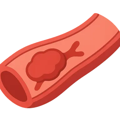 Thromboembolic complications
