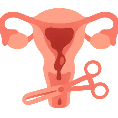 Surgical management of PPH