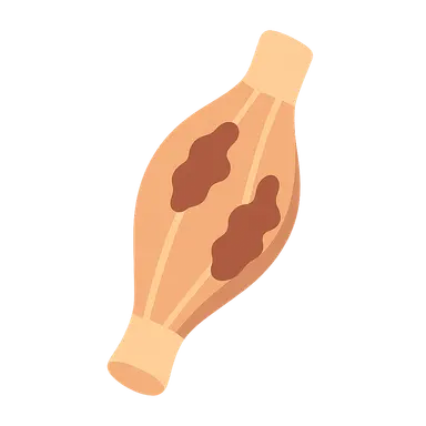 Skeletal muscle diseases