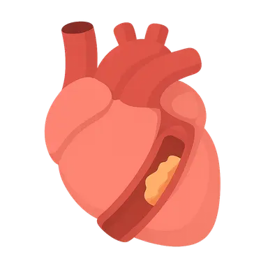 STEMI diagnosis and management