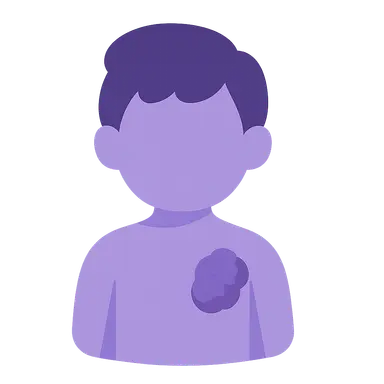 Cancer predisposition syndromes