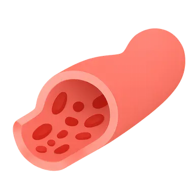 Acute tubular necrosis