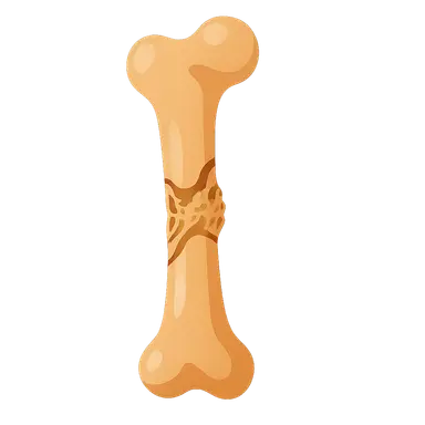 Fracture Healing Process