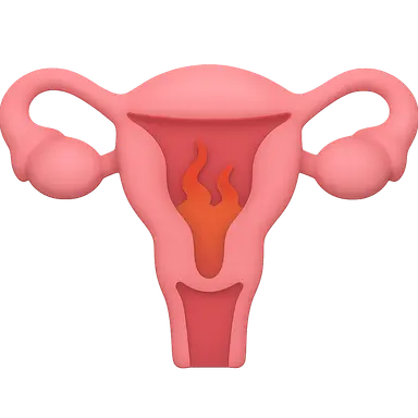 Primary Dysmenorrhea