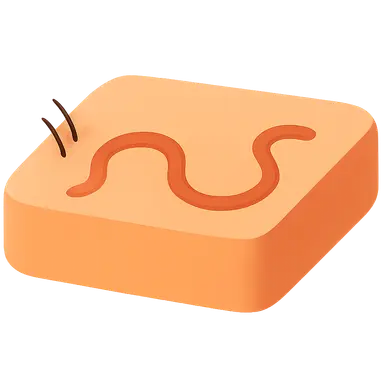 Cutaneous Larva Migrans