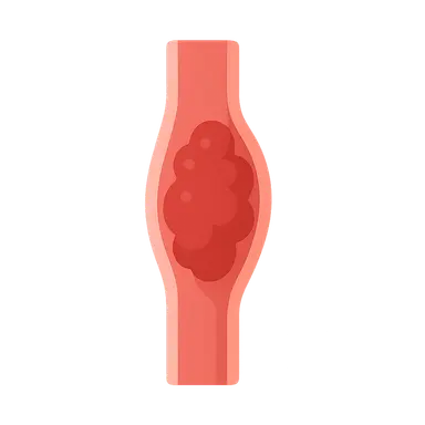 Venous thromboembolism