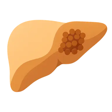 GSD type III (Cori disease)
