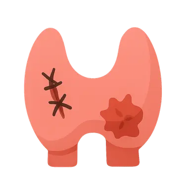 Endocrine surgery complications