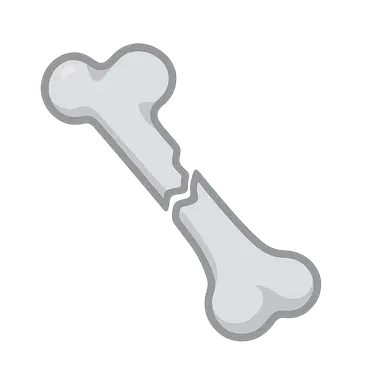 Fractures in Children