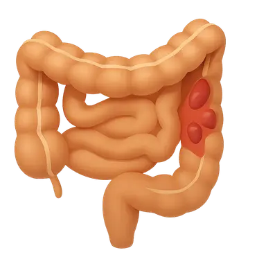 Drugs for Inflammatory Bowel Disease