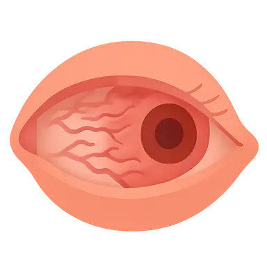 Cicatricial Conjunctival Disorders