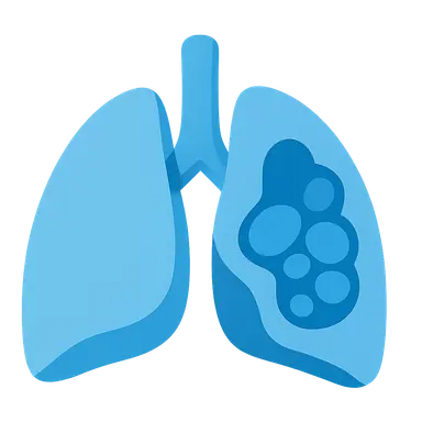 Congenital Lung Malformations