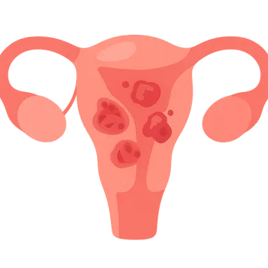 Postpartum Infections