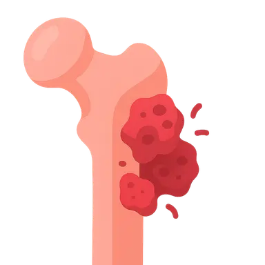 Osteomyelitis and Infectious Diseases