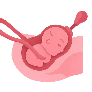 Operative Delivery (Forceps and Vacuum)