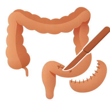Surgical management in IBD