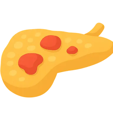 Acute pancreatitis etiology