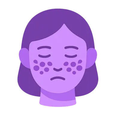 Systemic Lupus Erythematosus