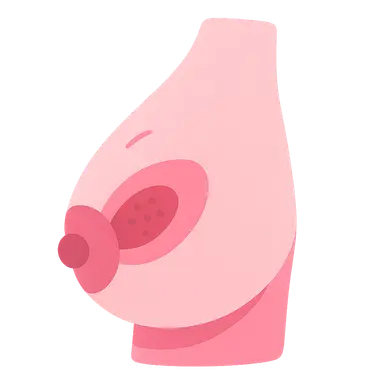 Breast conservation therapy