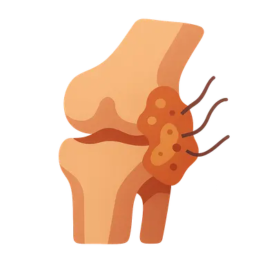 Fungal and Parasitic Infections