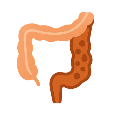 Medical management of Crohn's disease