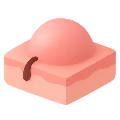 Benign Epithelial Tumors