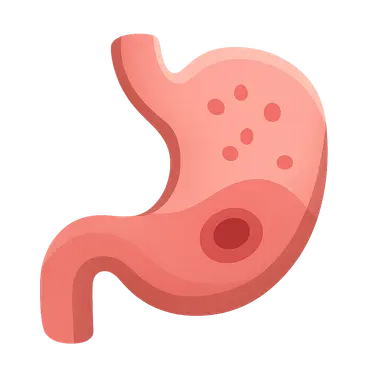 Gastritis and peptic ulcer disease