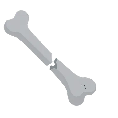 Upper Limb Fractures