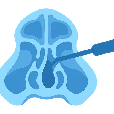 Sphenoid Sinus Surgery
