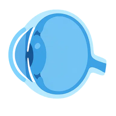 Primary Angle-Closure Glaucoma