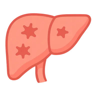 Graft-versus-host disease