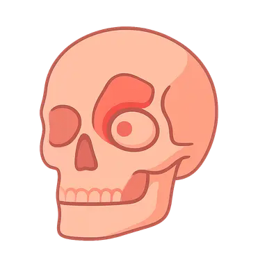Orbital Complications of Sinusitis
