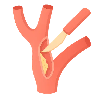 Carotid endarterectomy indications and technique