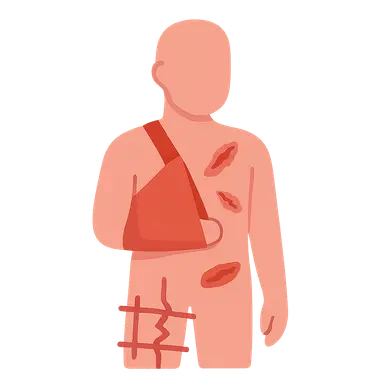 Polytrauma Management