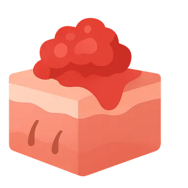 Squamous Cell Carcinoma