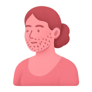 Hirsutism and Virilization