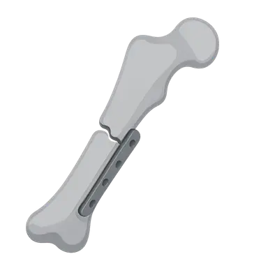 Principles of Fracture Management