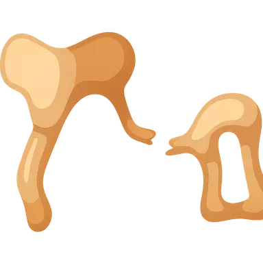 Traumatic Ossicular Disruption