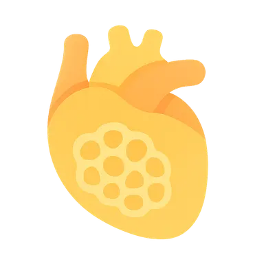 GSD type II (Pompe disease)