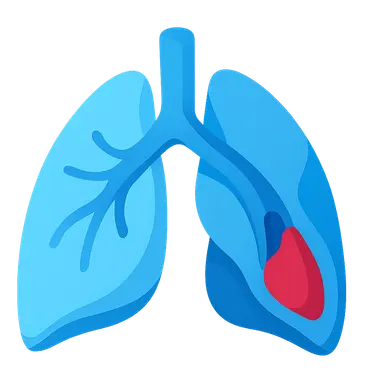 V/Q mismatch in pulmonary embolism
