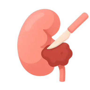 Renal cell carcinoma surgery