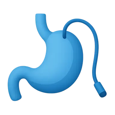 Nutrition in Critical Illness