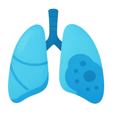 Pulmonary Complications