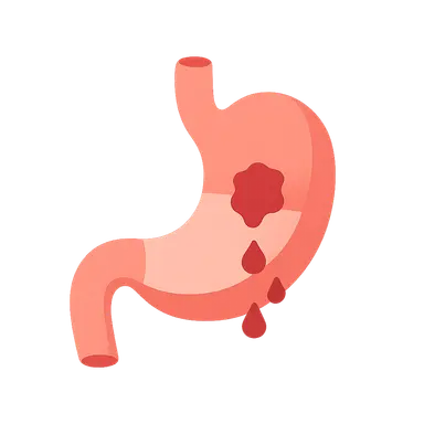 Gastrointestinal Bleeding