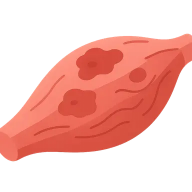 Skeletal muscle diseases