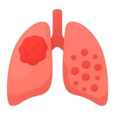 Lung tumors (primary and metastatic)