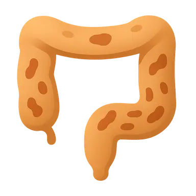 Medical management of ulcerative colitis