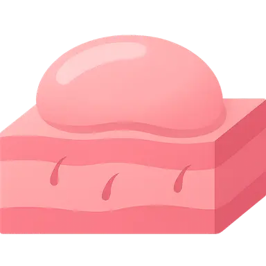 Vesiculobullous diseases